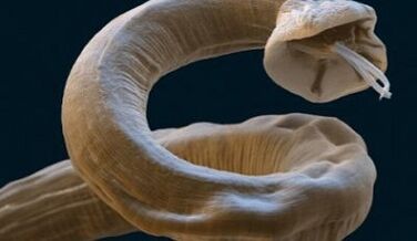 Ascaris is a parasite in the human body
