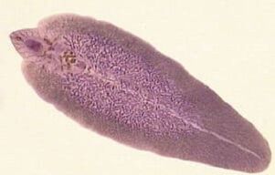 Pathogen of fascioliasis - Liver layer
