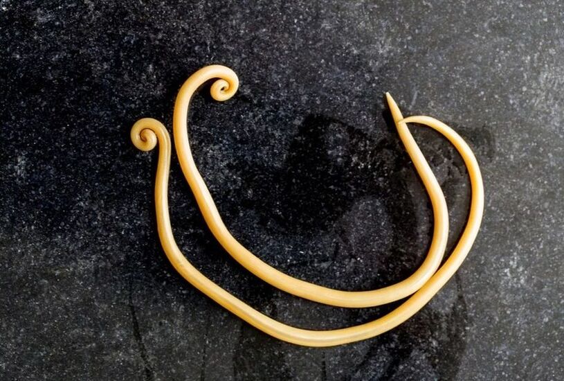 Roundworms are the most common parasites in the human body