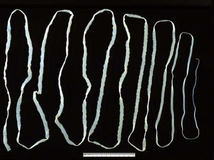 bovine tapeworm enters humans through beef