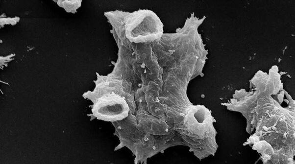 Negleria fowlera is a life-threatening protozoan parasite. 