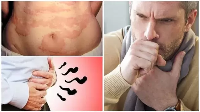 Allergy, cough and bloating are signs of damage to the body caused by worms