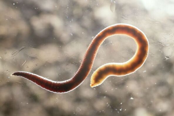 worm from the human body