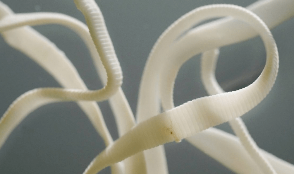 A tapeworm of impressive length