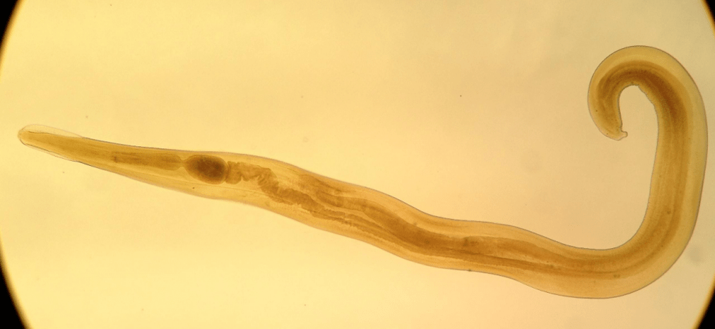Pinworm is a common parasite among children. 